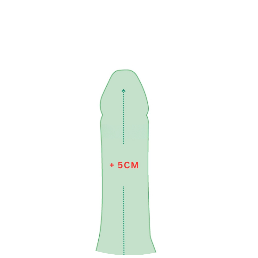 step